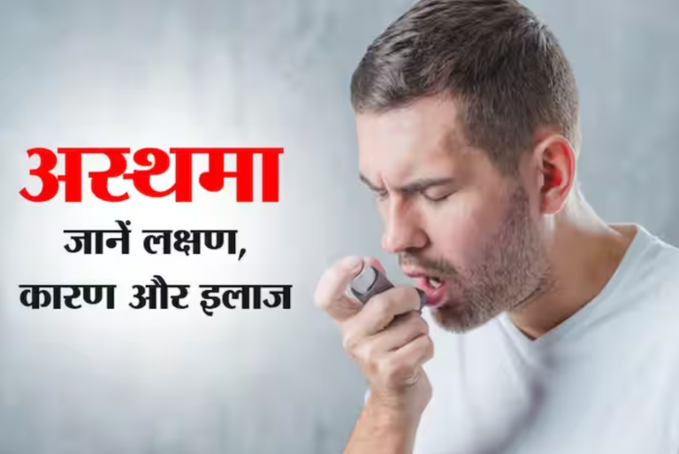अस्थमा: क्या है कारण और होम्योपैथिक इलाज- Cause & Homeopathic Treatment of Asthma