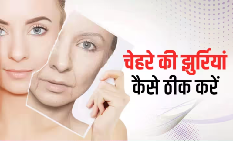 झुर्रियों की होम्योपैथिक दवाएं- Homeopathic Medicine for Wrinkles