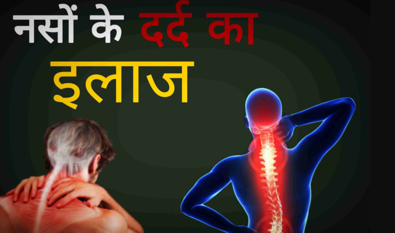 नसों में दर्द का घरेलू उपाय एवं आयुर्वेदिक उपचार – Home & Ayurvedic Diagnosis of Vein Pain