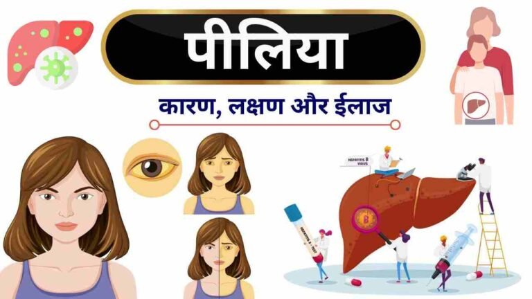पीलिया (Jaundice): जानिए कारण और इसका होम्योपैथिक उपचार