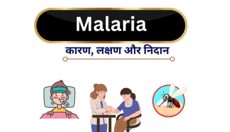 मलेरिया के कारण, लक्षण, आयुर्वेदिक उपचार, और रोकथाम